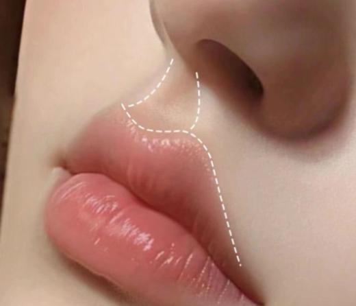 五、北京沈薇医生常见问题解答