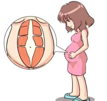 六、广州郑子良医生腹壁整形全流程指南(避坑点)