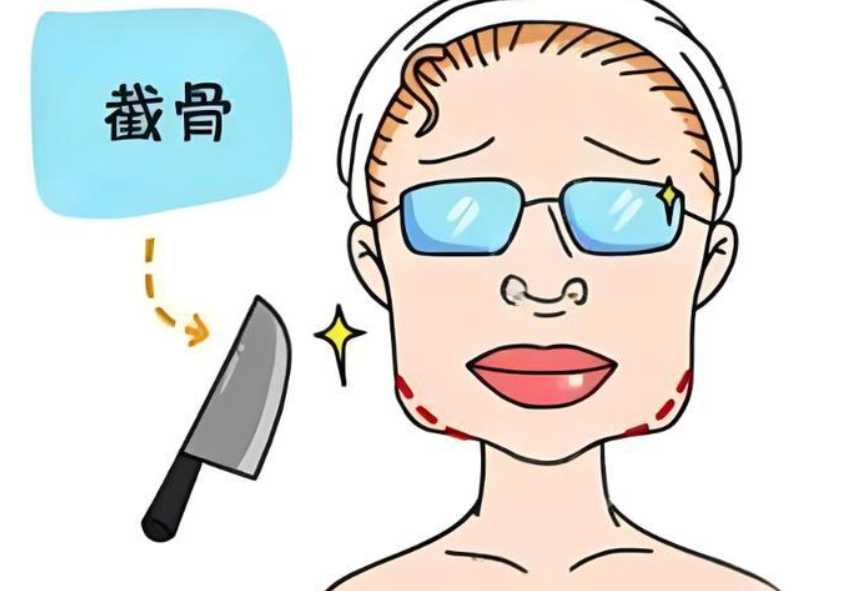 罗恩医生是亲自做手术吗?实测反馈:从画线到切骨,他都亲自上手确保线条流畅