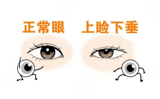 四、适合考虑郑永生修复方案的人群www.dlren.com