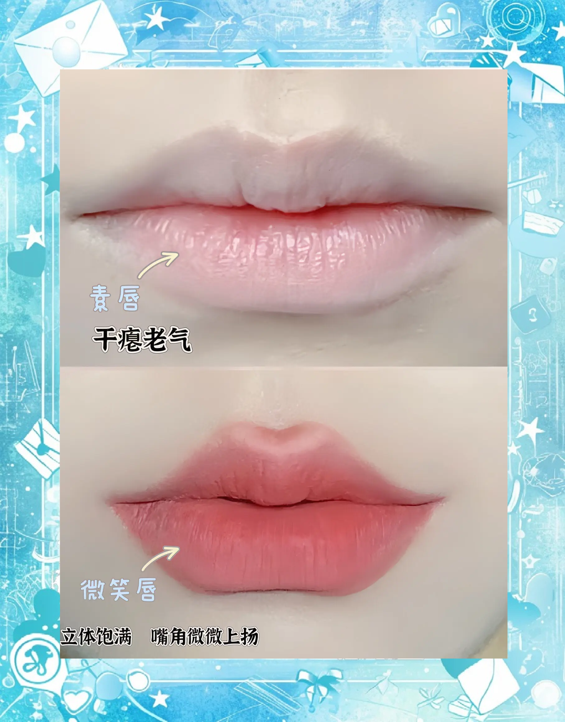 赵久丽微笑唇手术成效分享:术后三个月,不笑也自带亲和力,真的太减龄了!