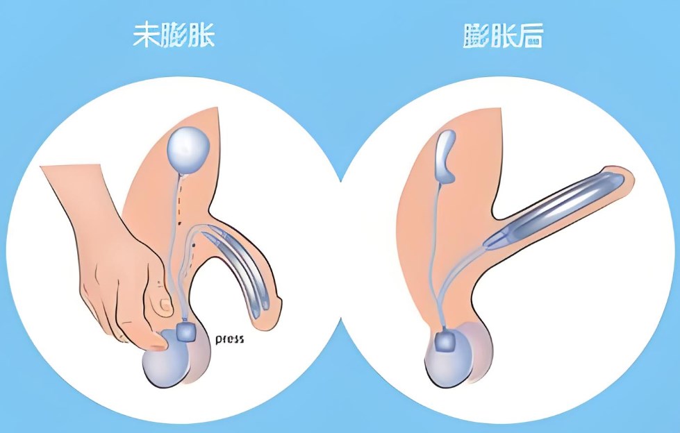 六、总结选择建议与行动步骤
