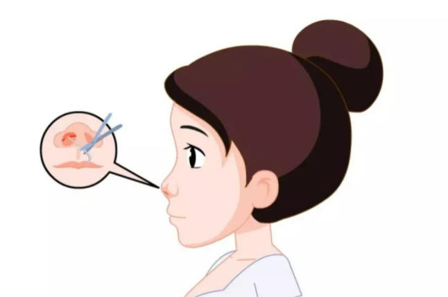 三、高顺福耳软骨隆鼻两万多贵不贵?搞清楚这些因素才能拿到准价
