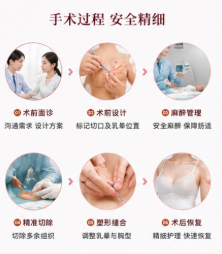 西安缩胸手术王爱武医生技术口碑咋样?4万元起价术后自然度获赞!亲测反馈满意度高!