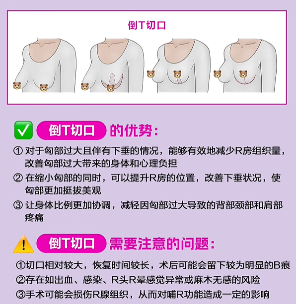 2. 哪些情况会导致费用上升?