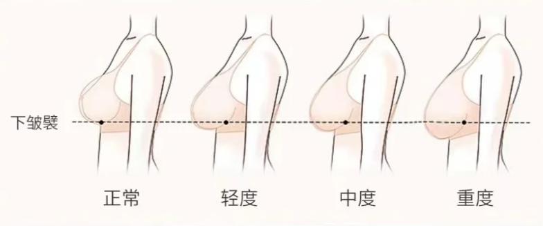 1. 术后变好期与心理预期www.dlren.com