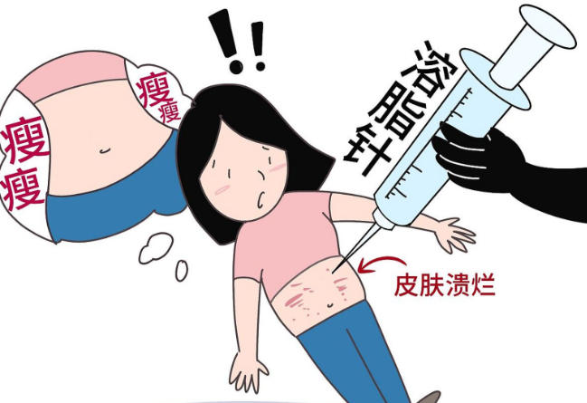 上海陈文龙抽脂靠谱吗?“点位线”均衡抽吸法,多隧道交叉操作,避免术后皮肤凹凸不平