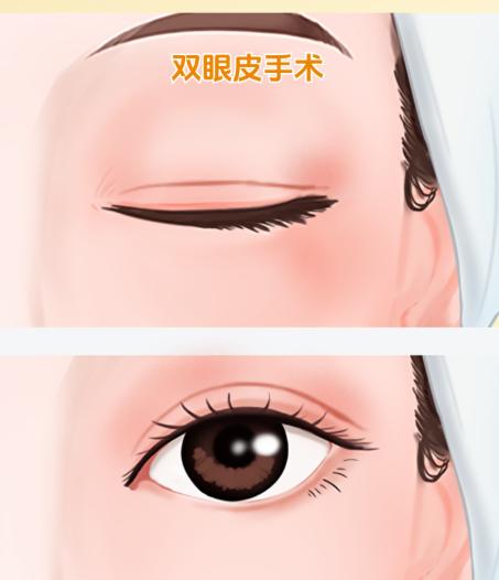 黄良飞医生处理哪些具体的眼修复问题