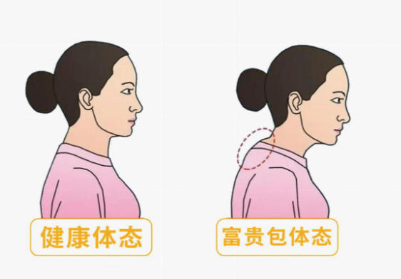 围绕黄学峰富贵包,你必须知道的避坑指南与核实要点
