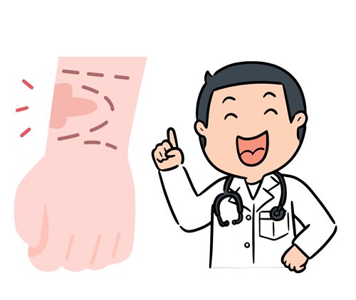 蒋水清增生疤痕修复口碑好,靠SRT-100浅放治疗增生疤痕,蜈蚣疤变细线!