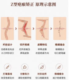 三、蒋水清增生疤痕修复价格与就诊指南www.dlren.com