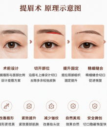 二、付乃裕医生的提眉技术到底咋样?这些用户范例给你答案