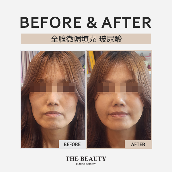 韩国The Beauty整形外科