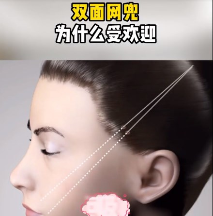 黄寅守拉皮手术价格贵吗?全面部提升108000元起,技术牛所以价格高