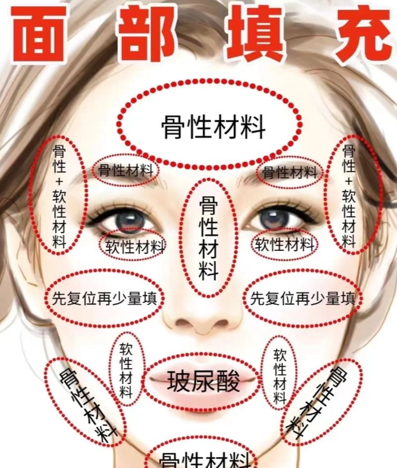 如何选择技术与医生?关键点剖析