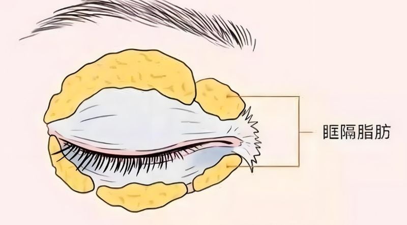 三、美卫士APP上怎么看滕双艳的真人双眼皮范例?