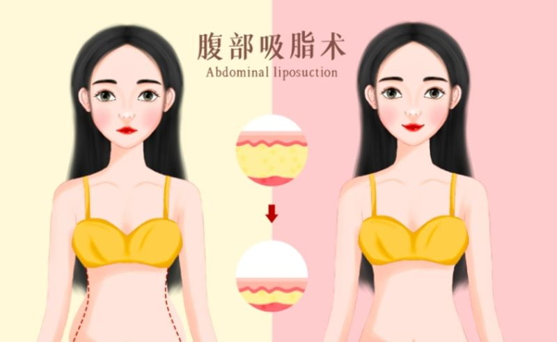 四、真实范例参考与审美风格
