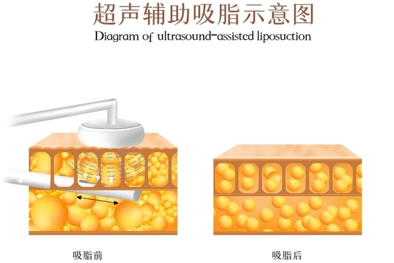 五、面诊前准备与预约挂号方式