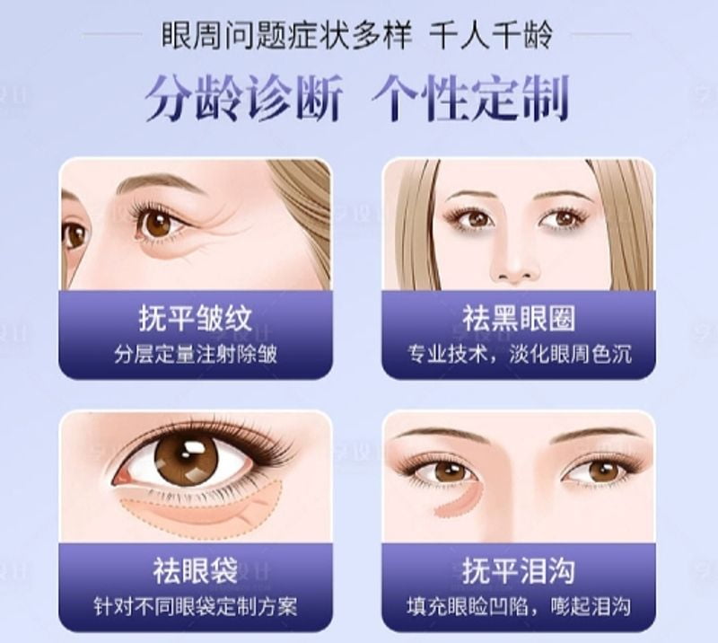 三、价格透明物有所值?毕珍医生做眼周项目贵不贵?