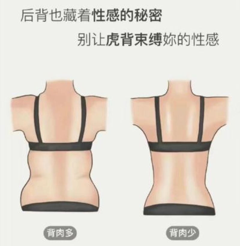 三、假体隆胸与自体脂肪丰胸——重手感更重安荃