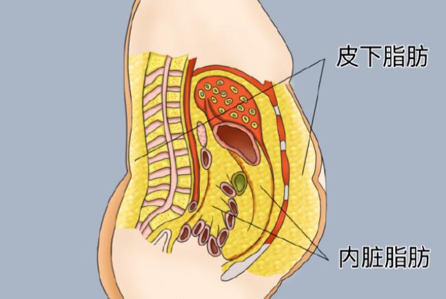 如何选择最适合你的腹壁成形术医生?
