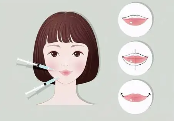 二、除了手术费,整容嘴唇变薄多少钱还会被这些隐藏项影响?