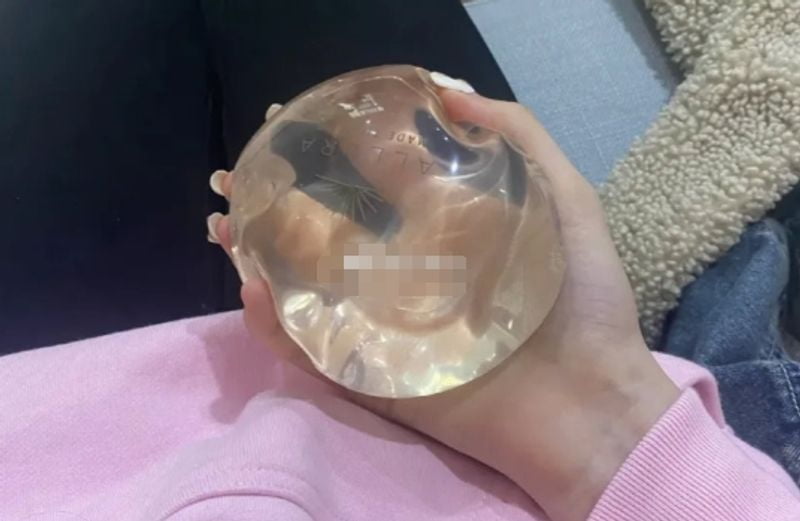 三、除了艾长安,杭州其他几位隆胸医生怎么选?
