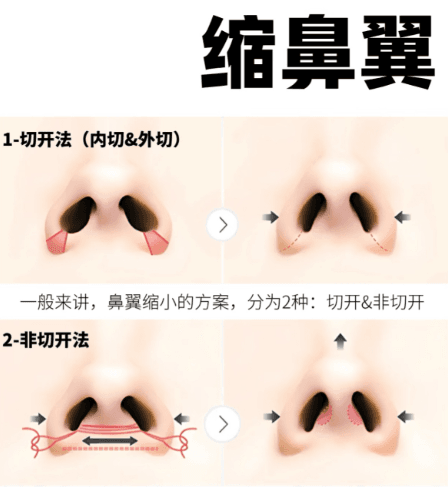 太原隆鼻哪家医院做得好?推荐4家技术好审美在线医院