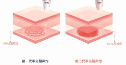 四、江门爱汇星医疗美容机构整体口碑与项目反馈www.dlren.com