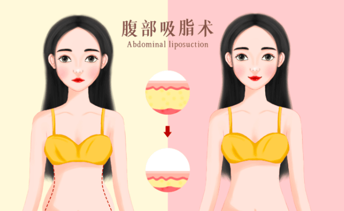 三、面诊郑州星格张叶鹏医生,我必须问清楚哪些问题?