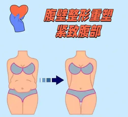 五、腹壁整形医生李献和面诊人多吗?真实预约流程与渠道