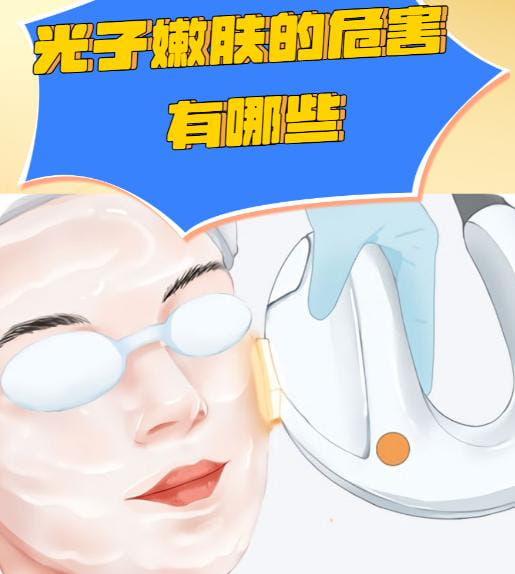 四、除了价格,做光子嫩肤前你必须知道的几件事