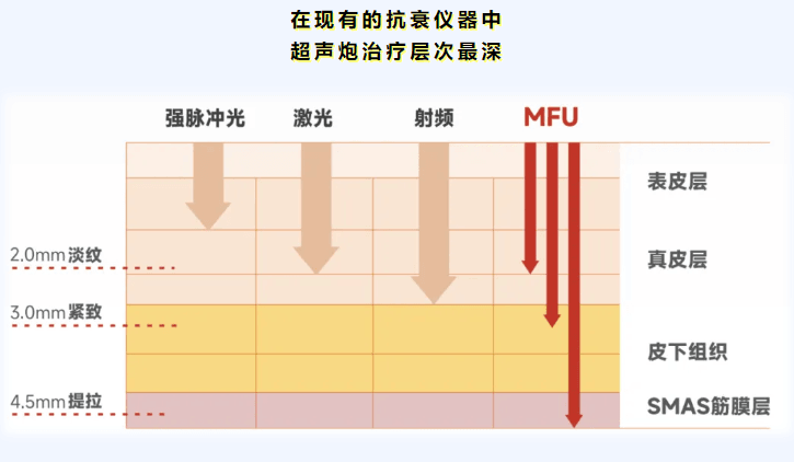 四、如何辨别与选择靠谱的超声炮治疗？避坑指南