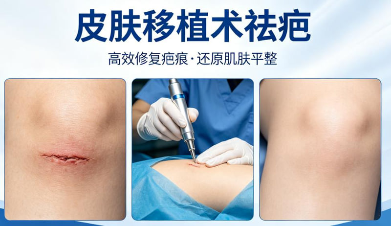四、如何判断自己是否适合在佛山华美进行祛疤治疗?www.dlren.com