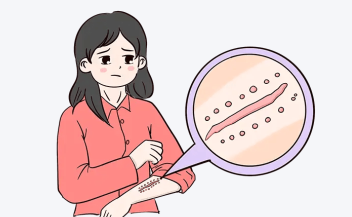 三、惠州鹏爱疤痕修复医生团队与擅长技术盘点www.dlren.com
