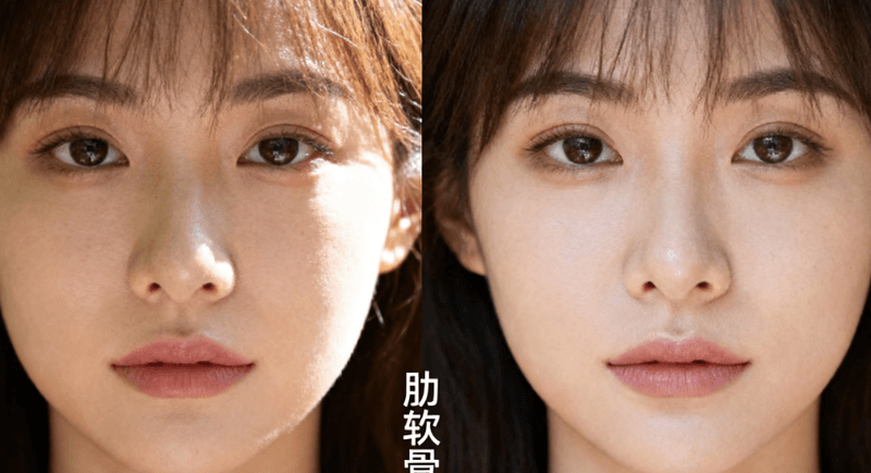 优法兰1毫升打鼻子够么?初鼻试水足够,追求明显效果得加量