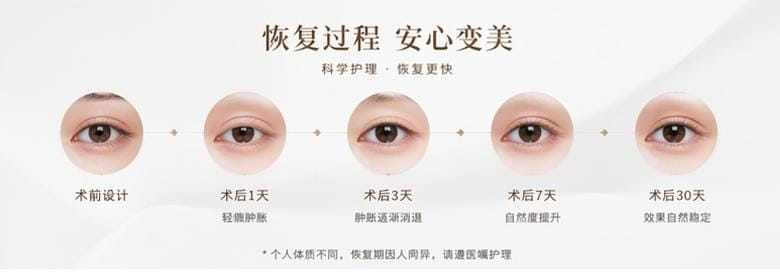 三、王衡健双眼皮手术过程疼吗?恢复到底快不快?