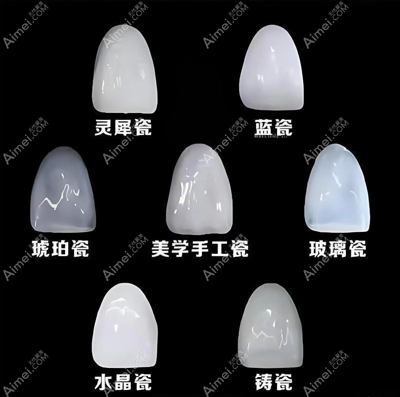 上海牙齿贴面怎么收费？不同材质价格有何区别，贝色对比上海医院收费