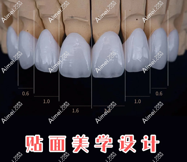 2026南京茀莱堡口腔牙贴面价格:树脂贴面299元起/颗,瓷贴面1500元,上贝色查完整报价