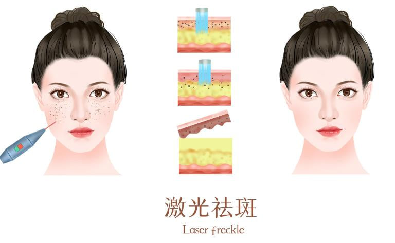 Q5:为什么美卫士上的价格比某些小诊所给的价格低,又比某些“美容院”高?
