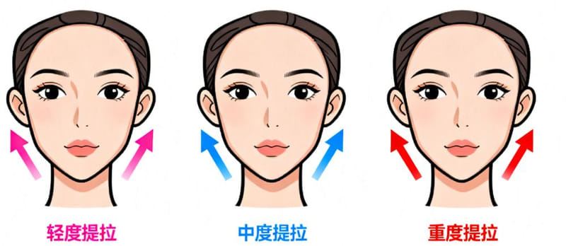 四、隋冰做面部提升贵吗?价格是不是透明?