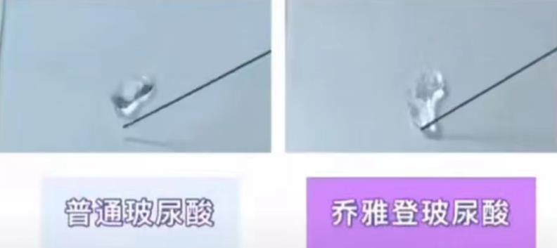 七、 总结:曙光医美王琳琳怎么样?给不同人的最终建议