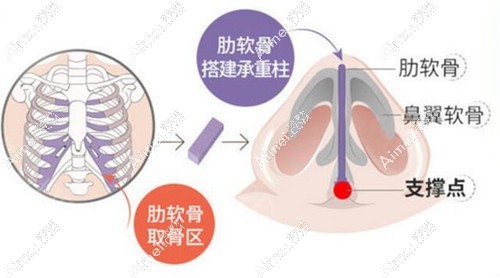 易普锋做鼻子技术图 易普锋做鼻子技术图