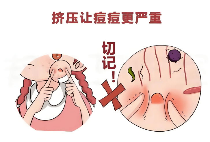 二、深入解析:领艺点阵激光如何针对性解决反复痘印痘坑www.dlren.com
