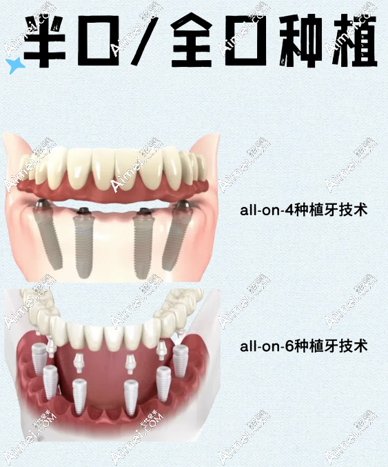 替爸妈跑完交底!广州柏德口腔半口种植牙真的只要2万?去贝色预约还能领免费CT名额!