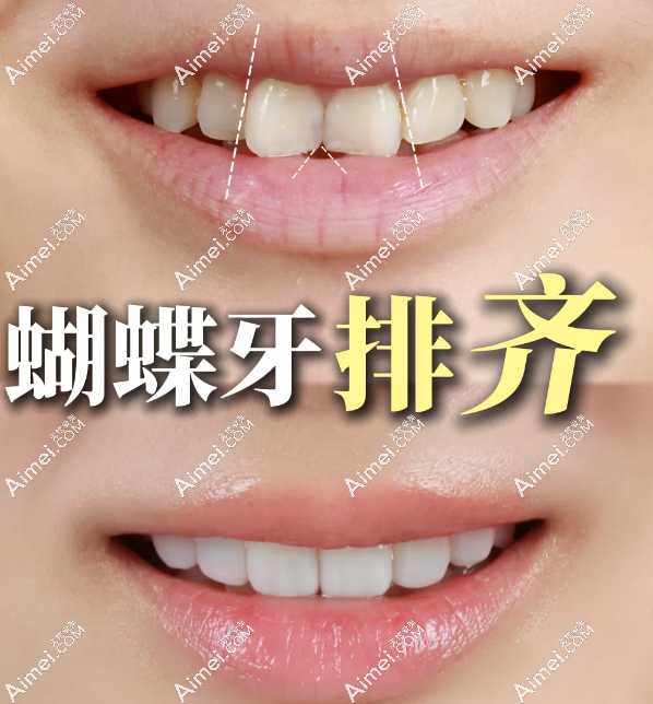 对比10家齿科!北京做牙齿贴片哪家好?超薄瓷贴面少磨牙,可做牙齿矫正/上贝色查医生资质