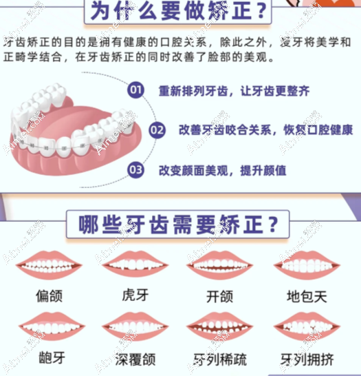 上贝色看东莞牙齿矫正哪家好？10 家正规口腔名单汇总及各类牙齿矫正优缺点对比