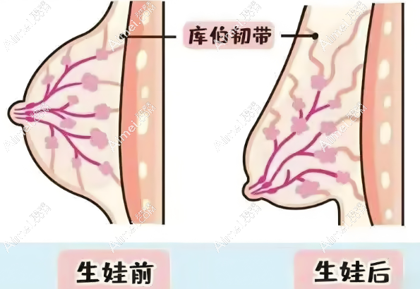 深圳南雅胸整形手术价格表www.dlren.com 深圳南雅胸整形手术价格表www.dlren.com