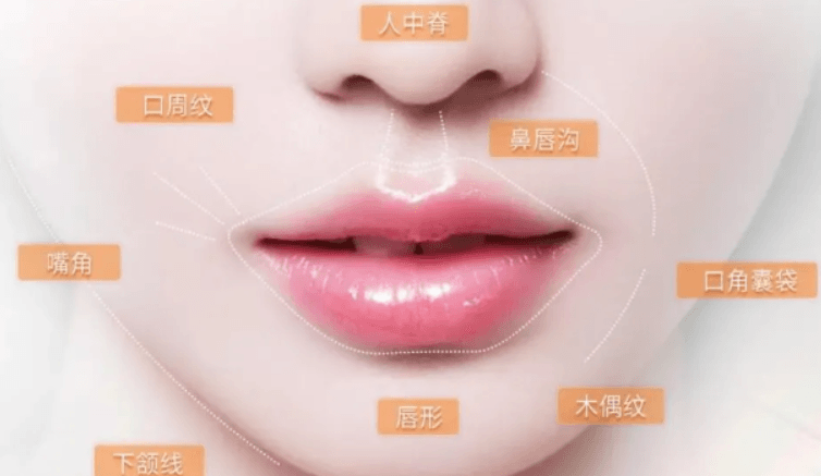 一、洛阳维多丽亚做口周年轻化改善法令纹具体费用是多少及美卫士优惠