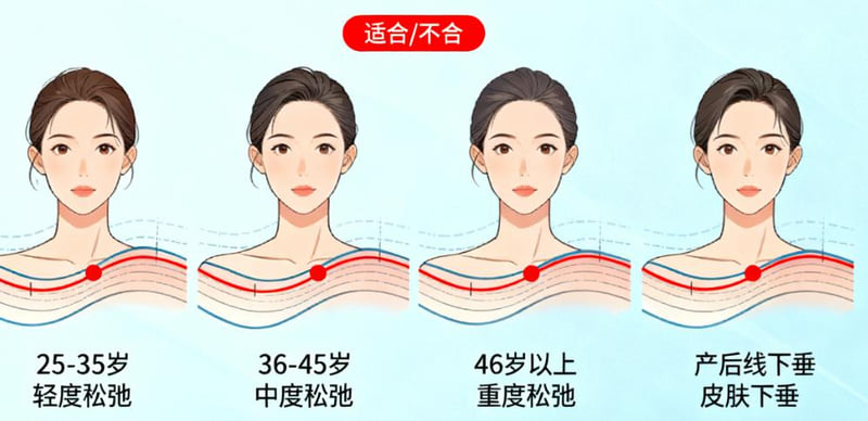 丽水心艺整形医生推荐徐继强、赵俊,从实例看徐医生擅长眼部手术,赵医生精于注射整形